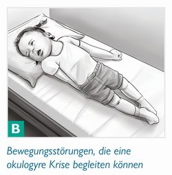 Epilepsie Fehldiagnose Verlagsbilder2