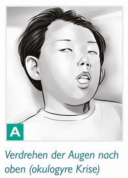 Epilepsie Fehldiagnose Verlagsbilder1