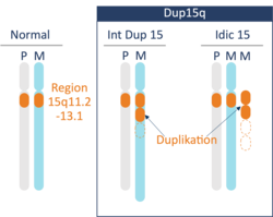 Dup15q Interview Dup15q Chromosom