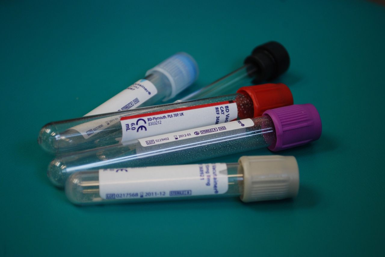 3 Medizinische Aspekte laboratory 313864 pixabay